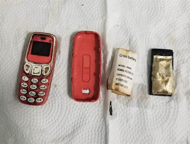 科索沃一名男子因為腹痛就診，醫生檢查後發現，他竟將一台Nokia手機吞下肚。(圖/翻攝自臉書/Skender Telaku)