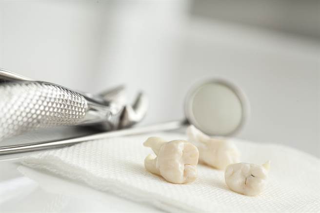 撞斷牙快撿起來用紙包或泡水--都不對！牙醫教你正確救牙3步驟。(示意圖/Shutterstock)