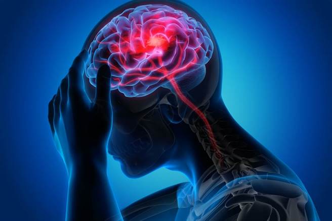 大腦各部位急性中風症狀大不同，小心慢性致殘。(示意圖/Shutterstock)