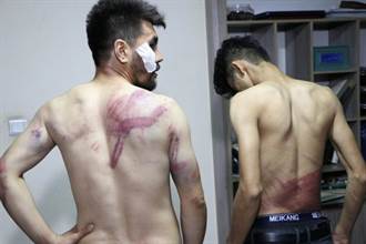 塔利班迫新聞自由 報導抗議活動的記者被打成重傷