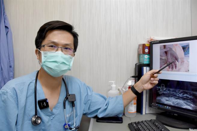 彰基医师林记贤表示，感染「创伤弧菌」，如果未即时处理，组织可能在几小时内严重坏死，甚至有致死的可能。（吴敏菁摄）