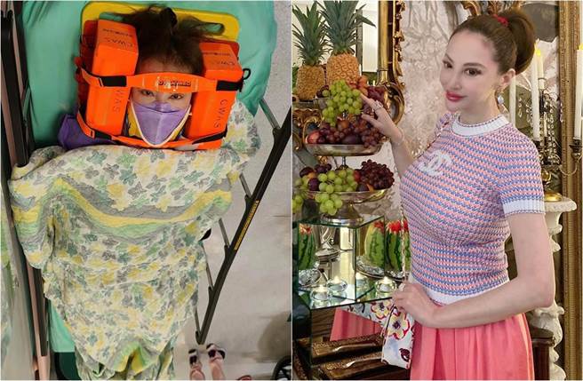 「社交皇后」薛芷伦出严重车祸，成了两车的夹心，送医照片也曝光。(取材自Fanny Sieh脸书)