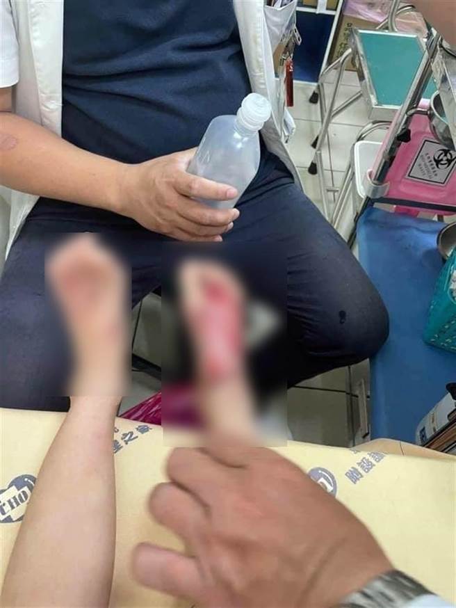 男童全身伤痕累累，两只脚足背部严重溃烂，鼠蹊部阴茎处也伤痕累累，令人不忍。（徐奕提供／谢琼云彰化传真）