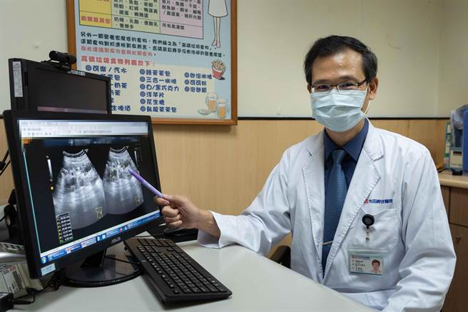 光田综合医院肾臟内科主任王家良说明，多囊肾为遗传性疾病，初期没有明显症状，有家族史应儘早检查。（王文吉摄）