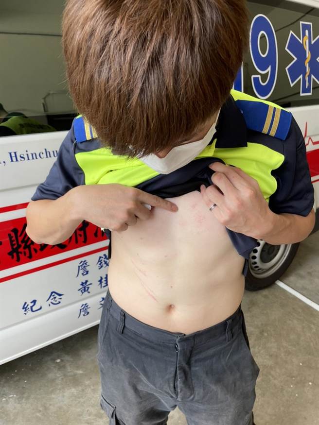 新竹县消防局竹东消防分队2名消防员，清晨执行救护勤务时，遭患者拳打脚踢，全身多处伤痕。（翻摄照片／庄旻静新竹传真）