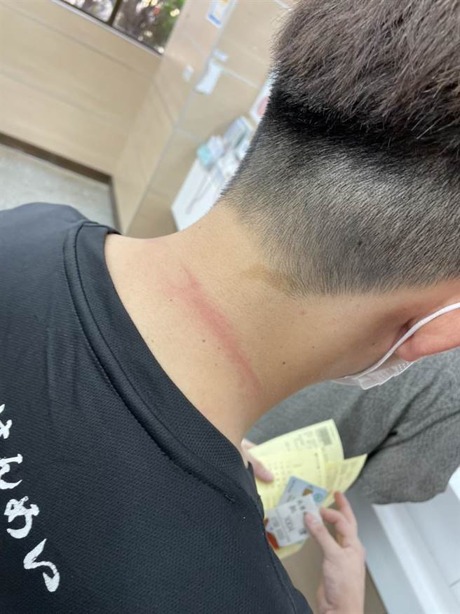 新竹县消防局竹东消防分队2名消防员，清晨执行救护勤务时，遭患者拳打脚踢，全身多处伤痕。（翻摄照片／庄旻静新竹传真）