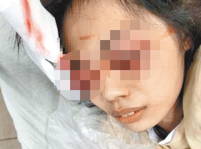 超商女店员遭疑患有精神疾病的杨姓男子袭击，双眼严重受伤。（翻摄画面／林和生屏东传真）