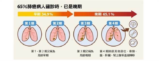 (图/康健杂志提供)