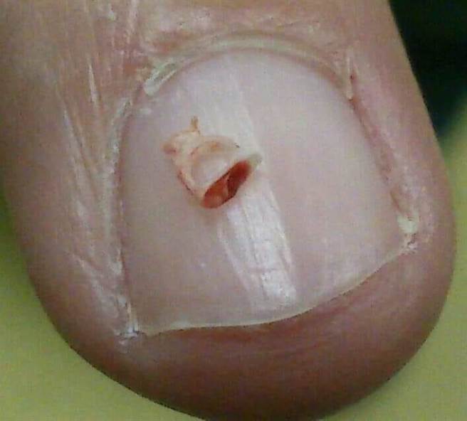 镫骨是全身最小的骨头，与中耳腔听骨链、内耳相连。（光田综合医院提供／陈淑娥台中传真）