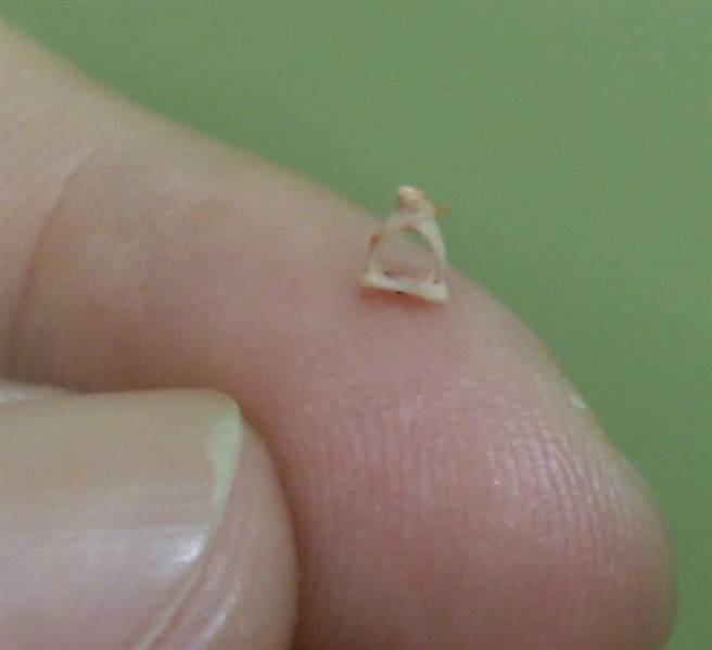 镫骨是全身最小的骨头，与中耳腔听骨链、内耳相连。（光田综合医院提供／陈淑娥台中传真）