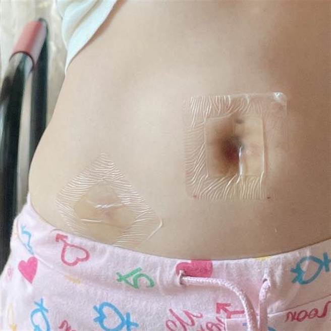 赖薇如伤势照曝光。（图／FB@赖薇如）