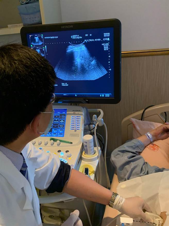 北榮內科部胃腸肝膽科主任黃怡翔為肝病患者檢查治療。（北榮提供／林周義台北傳真）