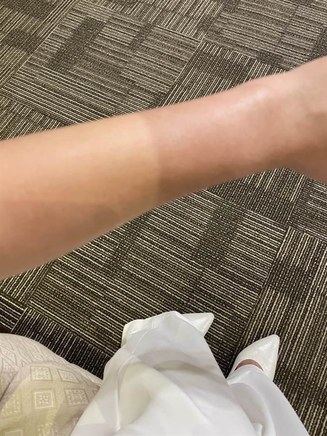 一场典礼下来，把丛慧芸的手晒出两个顏色。（丛慧芸提供）