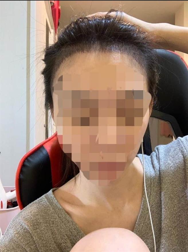 女网友分享自己髮际线纹绣的惨痛经歷。（翻摄爆料公社）