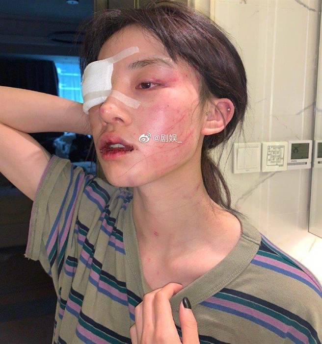 豬有蹄被打到差點毀容。(圖/翻攝自微博)