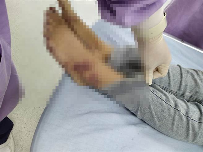 陈修将警方宣称，他14日有事外出回到旅馆后，发现胡女全身多处伤痕，直到今日（15）凌晨发现对方不太对劲、没有反应，才赶紧将人送往彰化医院急救。（民眾提供）