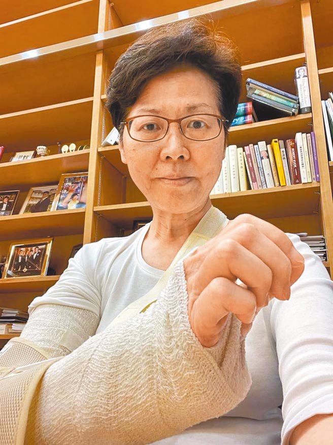 香港特首林鄭月娥18日晚在禮賓府跌倒，造成右手肘輕微骨折，她19日在臉書上傳照片，坦言現在最大難題是穿衣和寫字。（摘自林鄭月娥臉書）