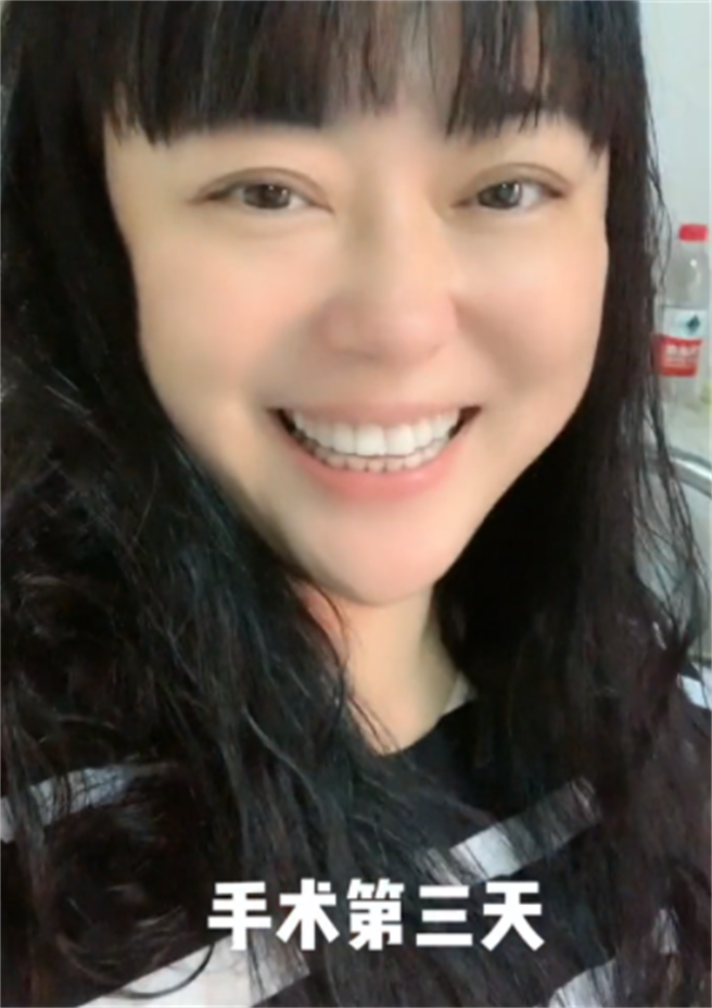 李菁菁本月初自曝罹患乳腺癌，脸蛋明显消瘦。(取自抖音)