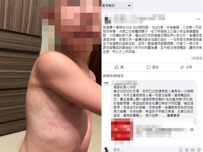 该网友事后给业者留下负评，强调业者始终未积极表示歉意，甚至不断推诿是毛毛虫引发过敏。（翻摄自脸书「爆料公社二社」）