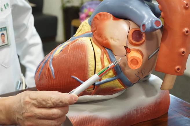 锺姓外送员疑因车祸扭力拉扯造成心臟破裂2.5公分。（王文吉摄）