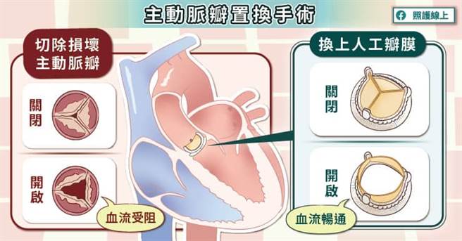 (图/照护线上提供)