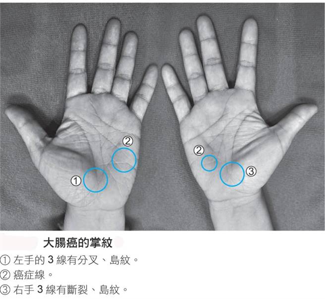 (图/《算癌症》时报出版提供。仅供参考，个人疾病须以就医确诊为准。)