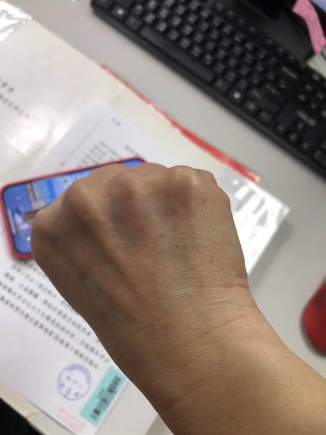 高雄市小港區一家未立案托嬰中心遭民眾檢舉，市府社會局社工前往現場突襲稽查，卻遭托嬰中心員工拒絕並在關門中夾傷社工手掌，經通知警方支援才得以入門稽查。(高雄市社會局提供／林雅惠傳真)