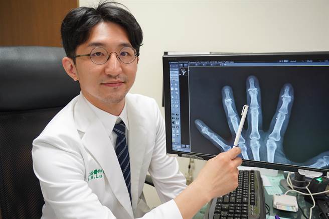 桃园市联新国际医院提醒，频繁使用手指，可能导致退化性关节炎，可热敷或适当伸展改善。（院方提供／赖佑维桃园传真）