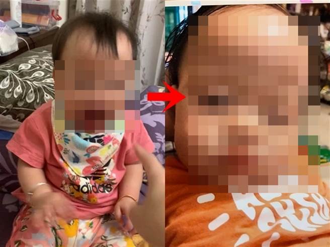 女嬰阿嬤今（4）曝光當時女嬰昏迷時保母拍下的照片，女嬰當時已臉部腫脹、眼睛微閉，詭異的是女嬰的衣服已被換掉，頭髮微濕，明顯已遭清洗。（翻攝自臉書）
