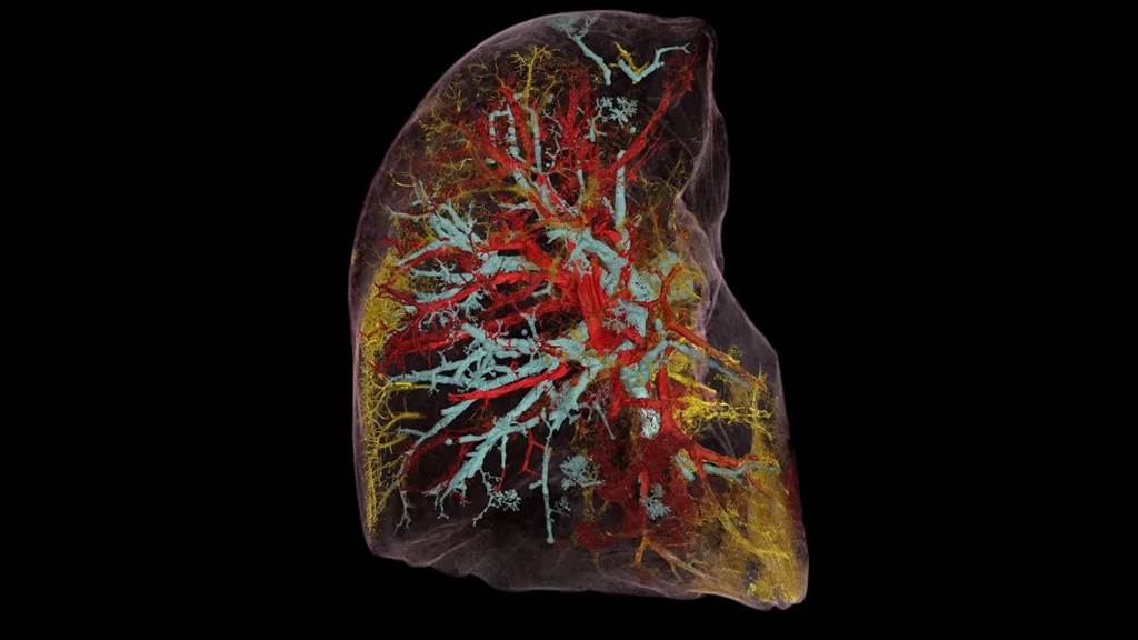 「分层相位对比断层扫描」 HiP-CT的效果，肺部的一切细节，包括末稍的微血管都很具体。图/伦敦大学(photo:ChinaTimes)
