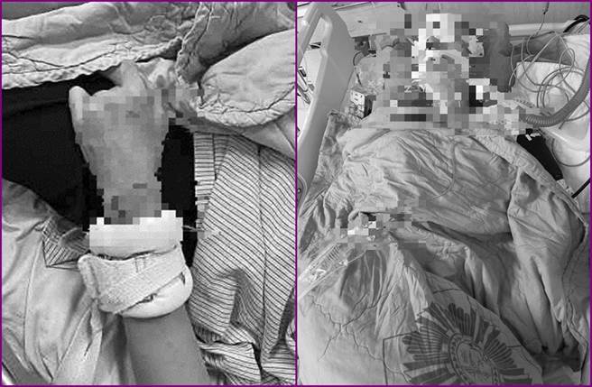 18岁大一宋男被打到颅内出血昏迷，仍在加护病房治疗。（民眾提供／卢金足台中传真）