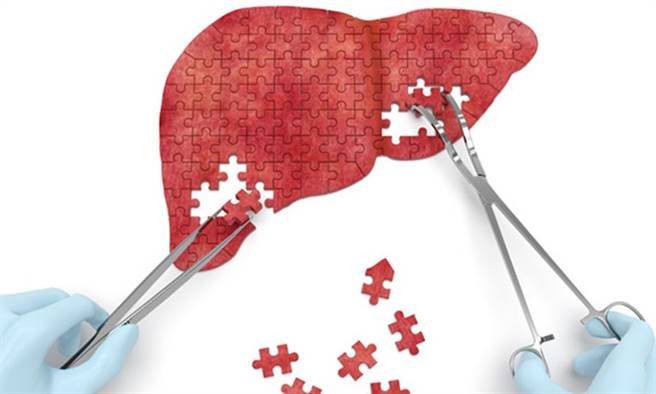 测出B肝病毒但无症状 别掉轻心！医警告：近4成机率变肝癌。(示意图/Shutterstock)