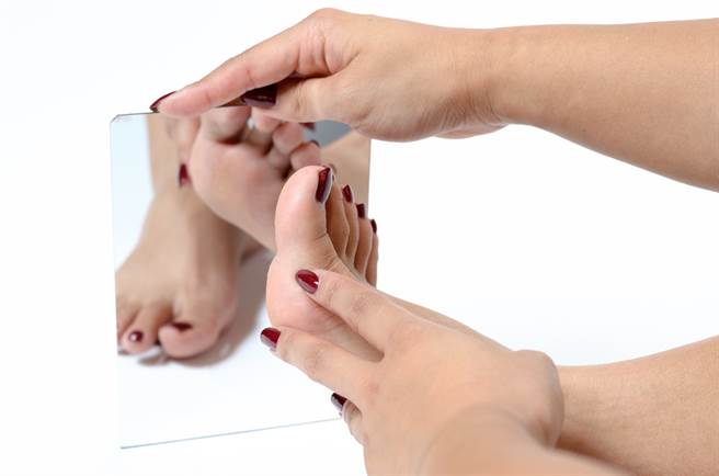 快看看手掌和脚底 长出这6种黑斑 恐是索命痣。(示意图/Shutterstock)