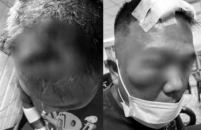 宜蘭一名賴姓計程車司機上月無故遭到陌生人打傷，上網控訴事發至今無人聞問。圖片經變色與馬賽克處理。（翻攝自臉書社團《爆料公社(官方粉專專屬)》）