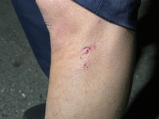 台南市警五分局立人派出所黄姓警员执行取缔酒驾勤务时，因陈姓毒品通缉犯驾车衝撞致手脚擦挫伤。（读者提供／洪荣志台南传真）