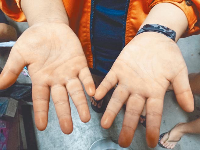 屏东万丹传有补习班不当管教，不仅打学童打到藤条断掉，还要孩子拿棍子互打，受害孩子伤痕累累。（翻摄画面／谢佳潾屏东传真）