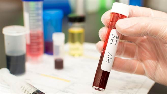一名阿根廷妇女自然治癒了艾滋病毒。(图/iStock)