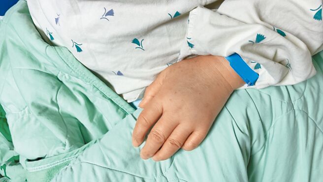 基隆市七堵区一名年约70岁陈姓妇人施打第一剂莫德纳疫苗后，出现急性脑栓塞不良反应。（读者提供／陈彩玲基隆传真）