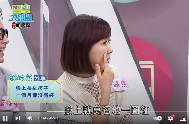 余皓然脸上长疹子，竟是王中平惹祸。（图／翻摄自民视综艺娱乐 Formosa TV Entertainments Youtube）