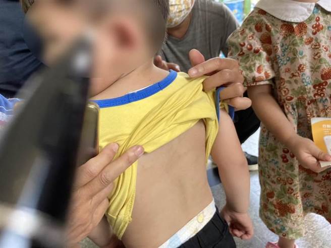 起訴書指出邱女虐待多名幼兒，除了徒手毆打施虐外，還會用膠帶綑綁、用高熱液體惡意澆燙，近日彰檢偵查終結，依兒少權益保護法、刑法傷害罪等罪嫌將2人提起公訴。（本報資料照片）