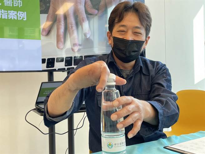 高雄47岁郑姓男子在一场工安意外中失去右手4根手指，高雄博田国际医院骨科部长吕俊宽及医师林高田共同操刀，将郑男的右脚趾移植到右手食指，让他右手重生，能再次写字、提物。（洪浩轩摄）