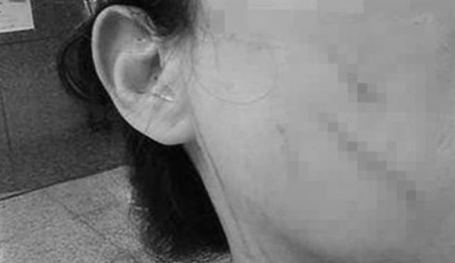 遭恶女邻挖眼砍30刀的女子，看到桃园超商命案就想到自己的遭遇，难过得想哭。（图／翻摄爆料公社）