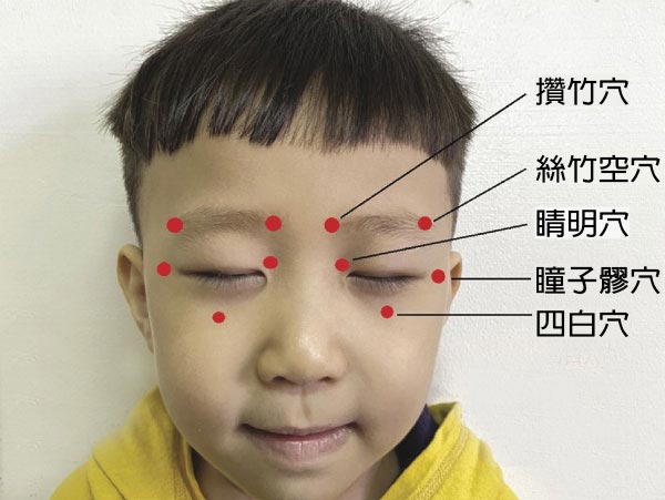 對抗兒童惡視力 中醫一起來幫忙