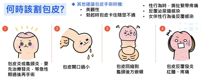 需要割包皮的必要时机点。（童综合提供／陈淑娥台中传真）