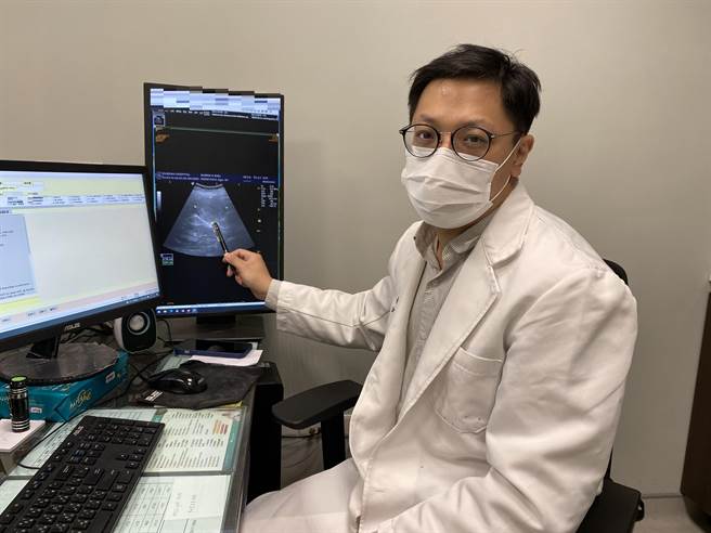 长安医院肝胆肠胃科医师许钰铨指出，从超音波检查可以发现肝臟右叶有约7公分大的肿瘤。（冯惠宜摄）
