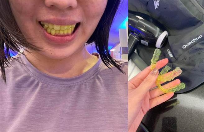 有网友带隐形牙套吃咖哩麵忘记拆，结果透明的牙套竟被染成萤光黄色。(图／翻摄自脸书社团爆废公社公开版) 