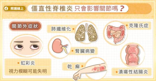 (图/照护线上提供)