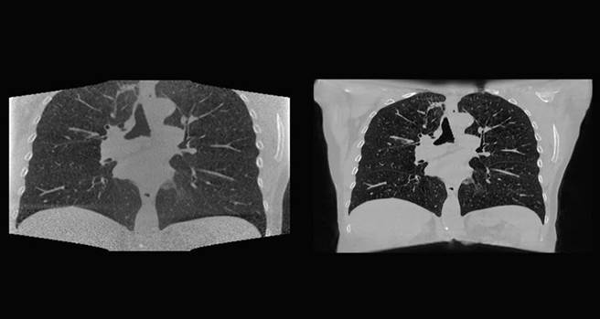 NKI透过AI模型，重建出更好的锥状射束电脑断层扫描（Cone Beam Computed Tomography；CBCT）胸腔影像，与传统方法相比，其影像画质更清晰。（图／业者提供）