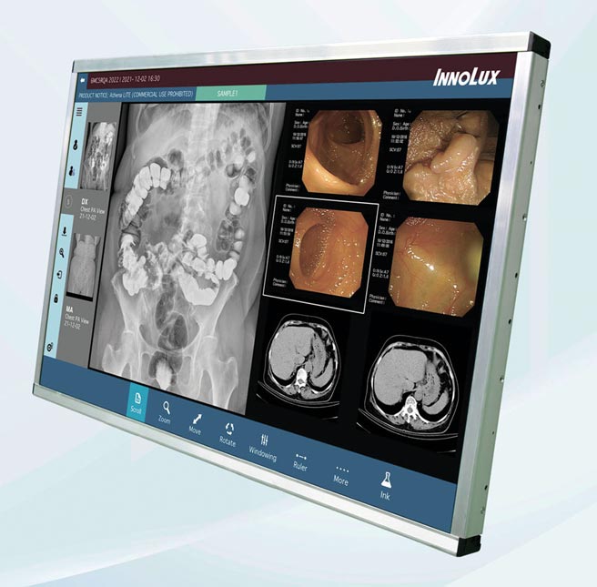 群创将展出30吋6M彩色诊断用医疗显示器，兼具2500:1高对比、1300nits高亮度特性，大尺寸可同时显示多种医学影像，有效提高医护工作效率。图／群创提供