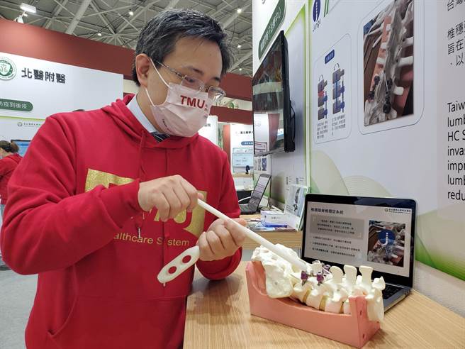臺北医学大学附设医院骨科部脊椎骨科主任吴孟晃解说，如何运用「椎稳强脊椎稳定系统」协助脊椎手术病患更优质的预后生活。（北医附医提供）